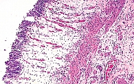 Рисунок. Поверхностный гликозаминогликановый слой слизистой оболочки мочевых путей (окраска гематоксилином и эозином, увеличение в 100 раз)