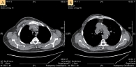 Рис. 1. Рентгеновская компьютерная томография органов брюшной полости