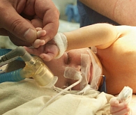 В Томском НИИ кардиологии освоен весь спектр операций при врожденных пороках сердца независимо от веса и возраста ребенка