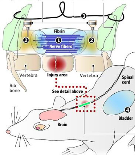 С помощью двух десятков нервных волокон ученые соединили разорванный спинной мозг. На рисунке видны нервные волокна и тонкий металлический проводок, защищающий новое нервное соединение от обрыва