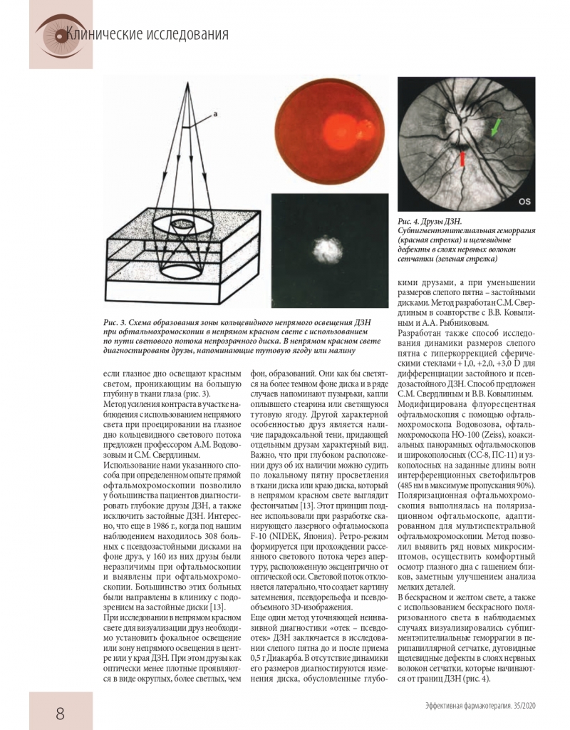 effektivnaya_farmakoterapiya_oftalmologiya_2_2020_pages-to-jpg-0010.jpg