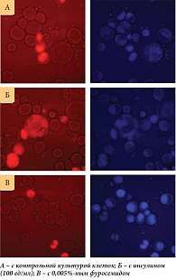 Рис. 3. Фотографии культур апоптотических и некротических асцитных клеток in vitro после 24-часовой инкубации:
