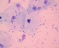 Рис. 6. Микроскопическая картина нормального влагалищного мазка (после лечения). По результатам ПЦР-диагностики – нормоценоз