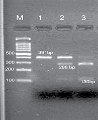 Анализ гена р53, полиморфизма rs1042522. Маркер-ДНК, молекулярный вес маркера VIII (Roche Applied Science, Mannheim, Germany)